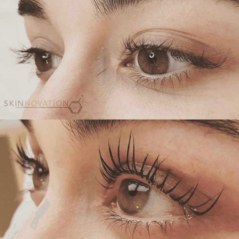 Lashes Before and After