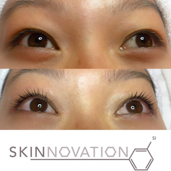 lashes/lash-lift-before-after-3